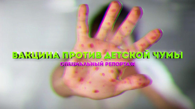 Корь. Чем опасна эта инфекция?