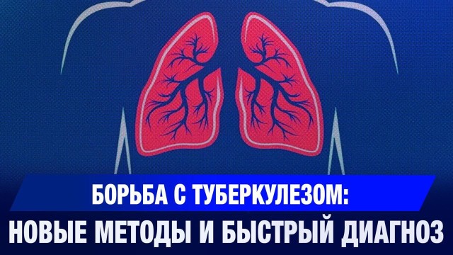 Борьба с туберкулёзом: новые методы и быстрый диагноз