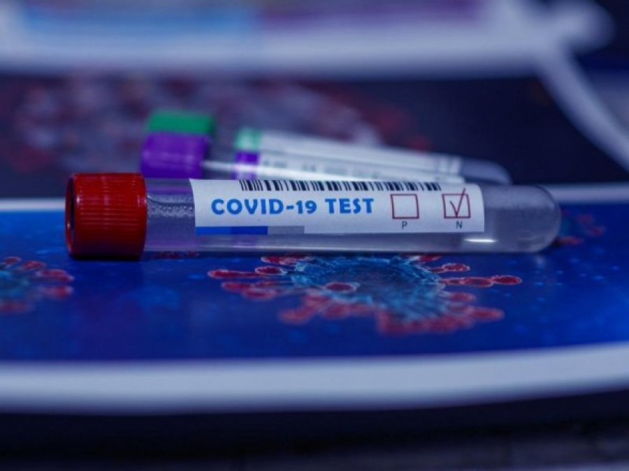 В Казахстане снизилось количество выявленных случаев COVID-19 за сутки